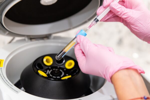 EZ Gel PRP preparation — spinning blood in a centrifuge at Skin Plus Beauty