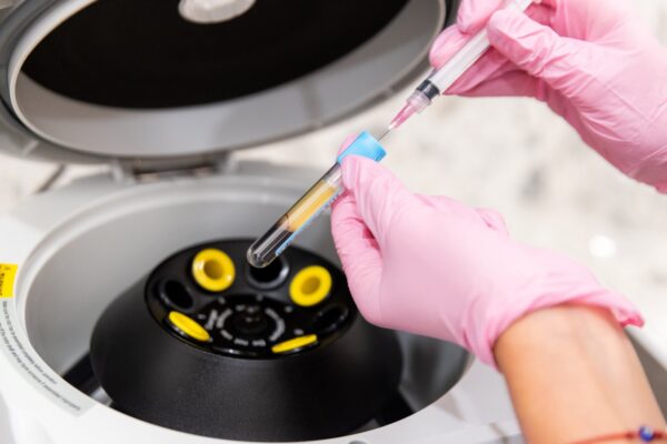 EZ Gel PRP preparation at Skin Plus Beauty