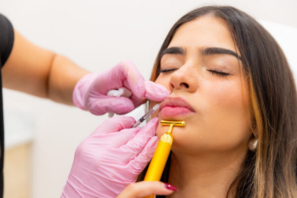 Lip Filler