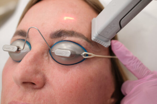 CoolPeel Fusion Laser