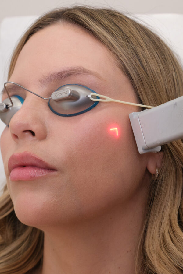CoolPeel treatment at Skin Plus Beauty