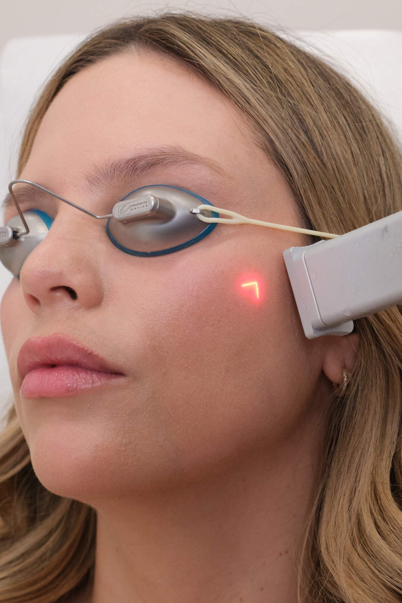 CoolPeel treatment at Skin Plus Beauty