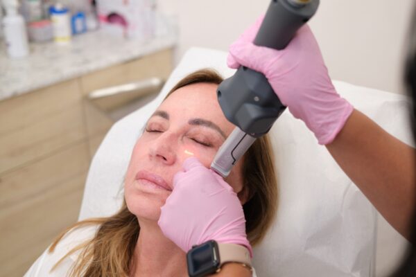 Deka CO2 Fusion (Total Skin Renewal)