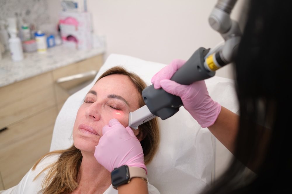 Deka Fusion CO2 Laser